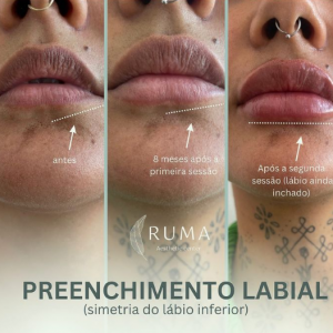 o contorno renovado, você vai se apaixonar novamente pelo que vê no espelho. Cuidar de si é mais do que vaidade, é amor!