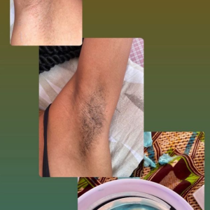 SERVIÇOS DE DEPILAÇÃO