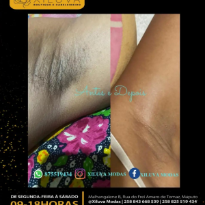 SERVIÇOS DE BELEZA _  DEPILAÇÃO