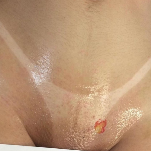 SERVIÇOS DE DEPILAÇÃO